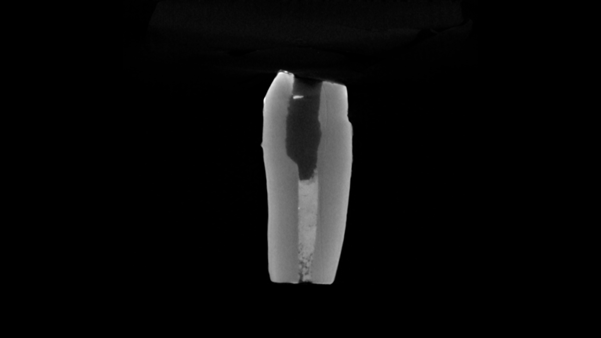 Immature Teeth