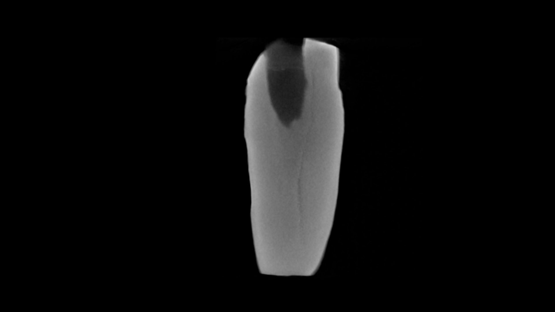 Immature Teeth